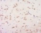 Neuronal thread protein AD7c-NTP Rabbit pAb